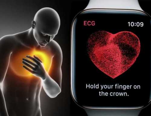 သွား ဆရာဝန် ၁ ယောက်ရဲ့ အသက်ကို ကယ်တင်လိုက်တဲ့ Apple Watch