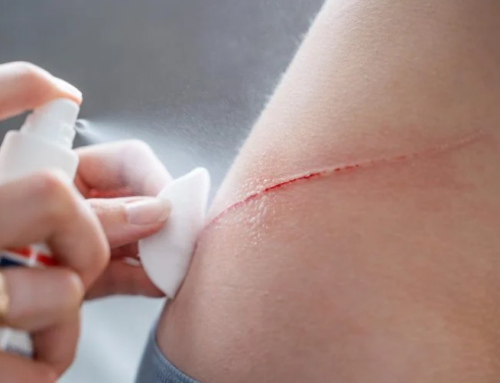 ၁ စက္ကန့်အတွင်း သွေးတိတ်စေမယ့် ကိုရီးယားပညာရှင်တွေရဲ့ “မှော်စပရေး”